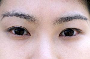 【2026年最新】世田谷区で選ぶべき美容皮膚科ベストガイド｜肌悩み別に徹底解説